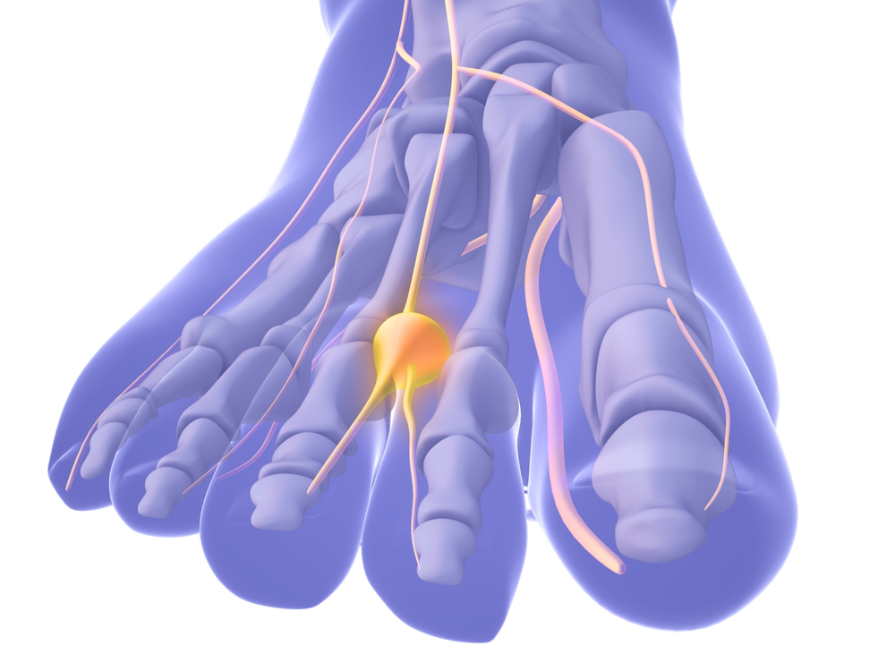 Illustration of a nerve system with a focus on a neuron.