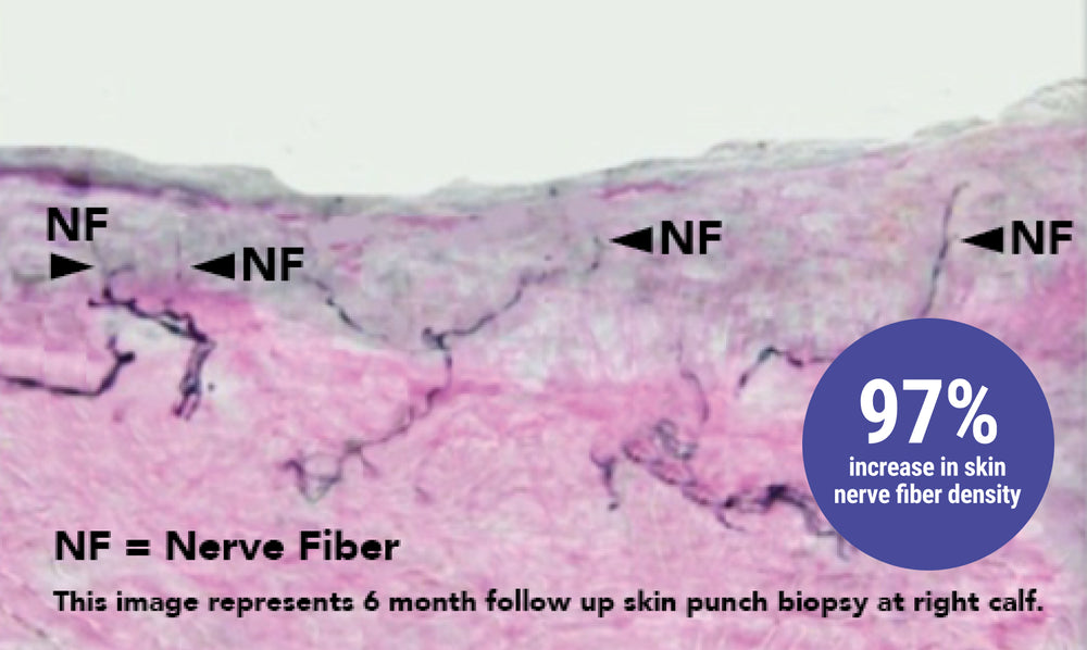 Microscopic view of skin tissue with nerve fibers labeled, showing a 97% increase in density.
